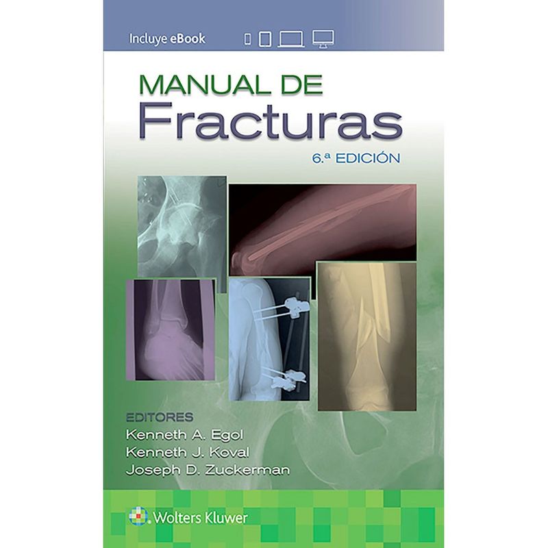 EDITORIAL MEDITERRANEO - Libro Manual De Fracturas 6ª Edición