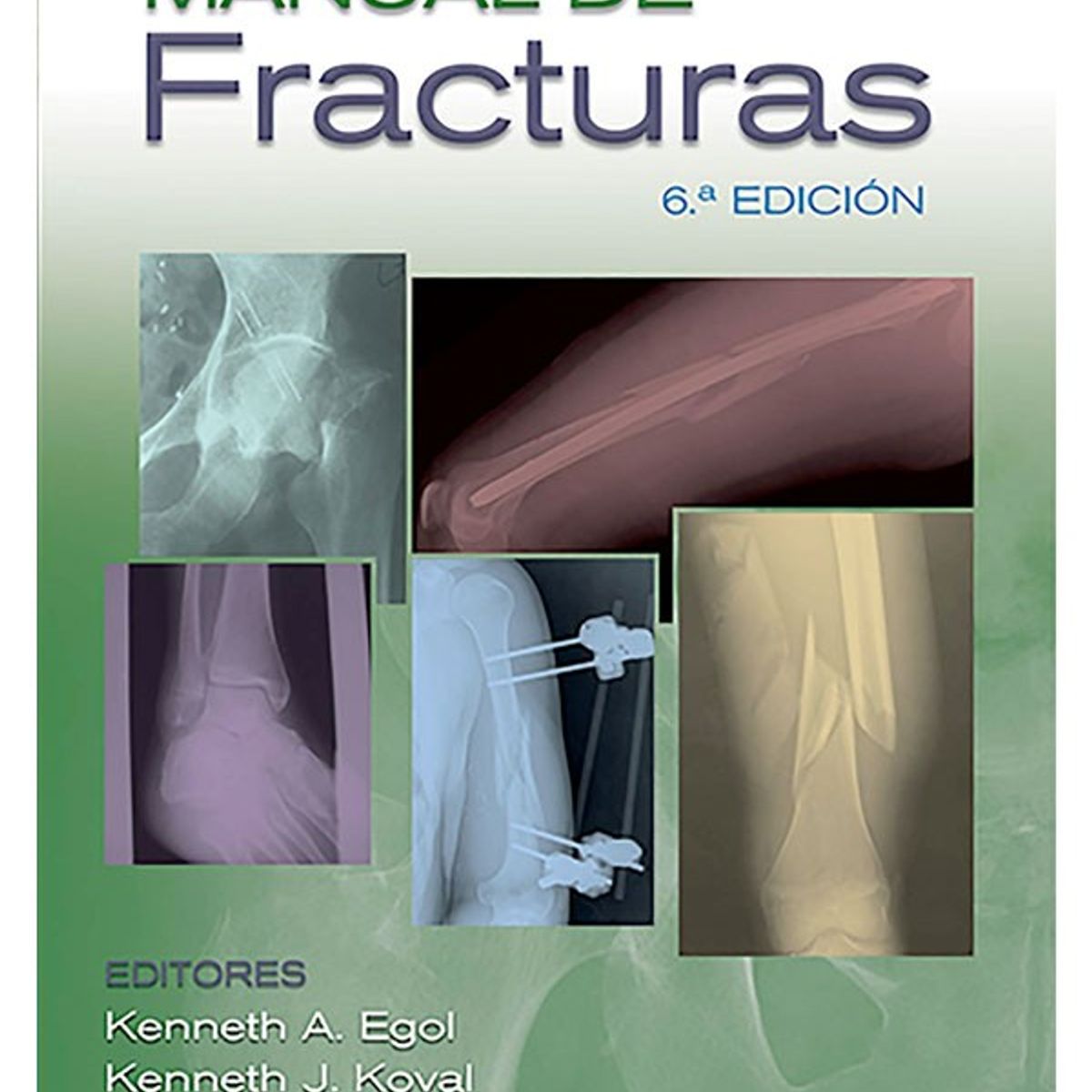 EDITORIAL MEDITERRANEO - Libro Manual De Fracturas 6ª Edición
