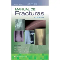 EDITORIAL MEDITERRANEO - Libro Manual De Fracturas 6ª Edición