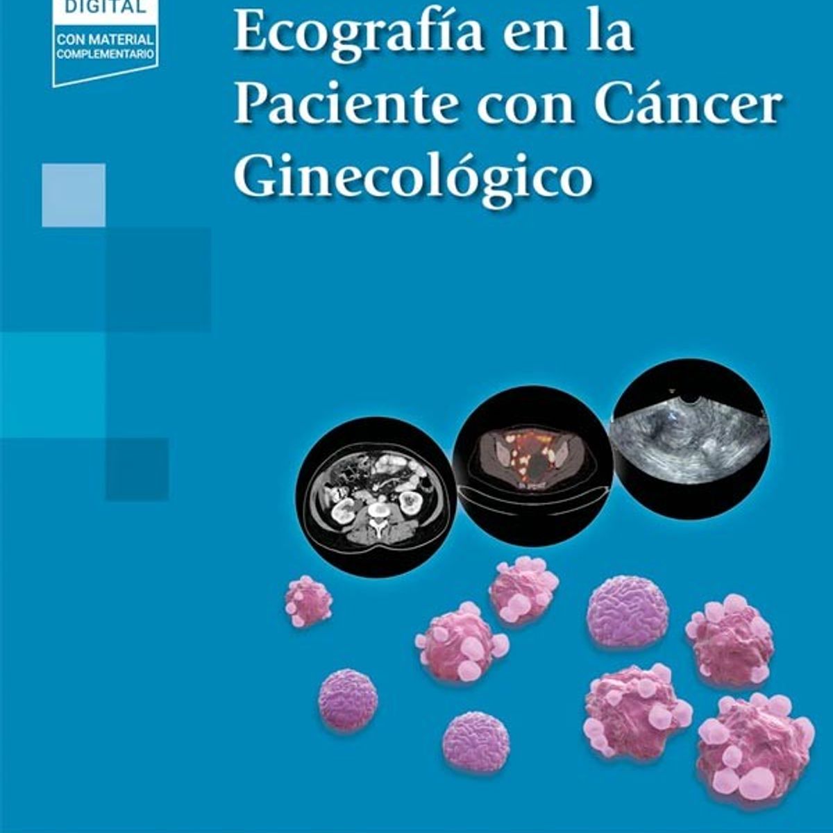 EDITORIAL MEDITERRANEO - Libro Ecografía En La Paciente Con Cáncer Ginecológico