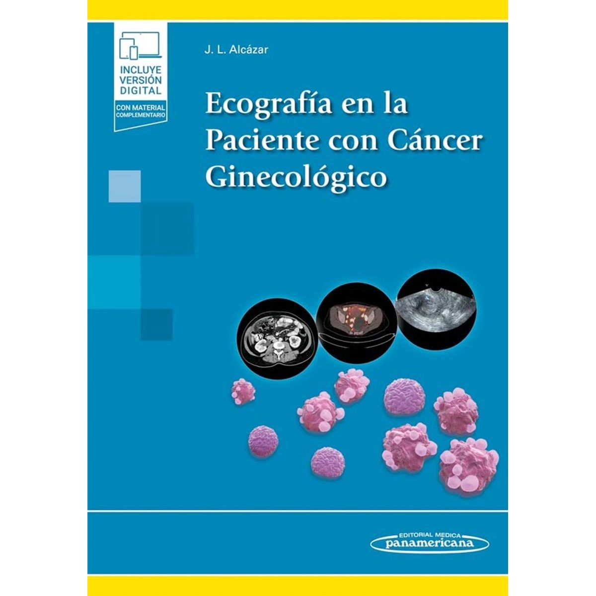 EDITORIAL MEDITERRANEO - Libro Ecografía En La Paciente Con Cáncer Ginecológico
