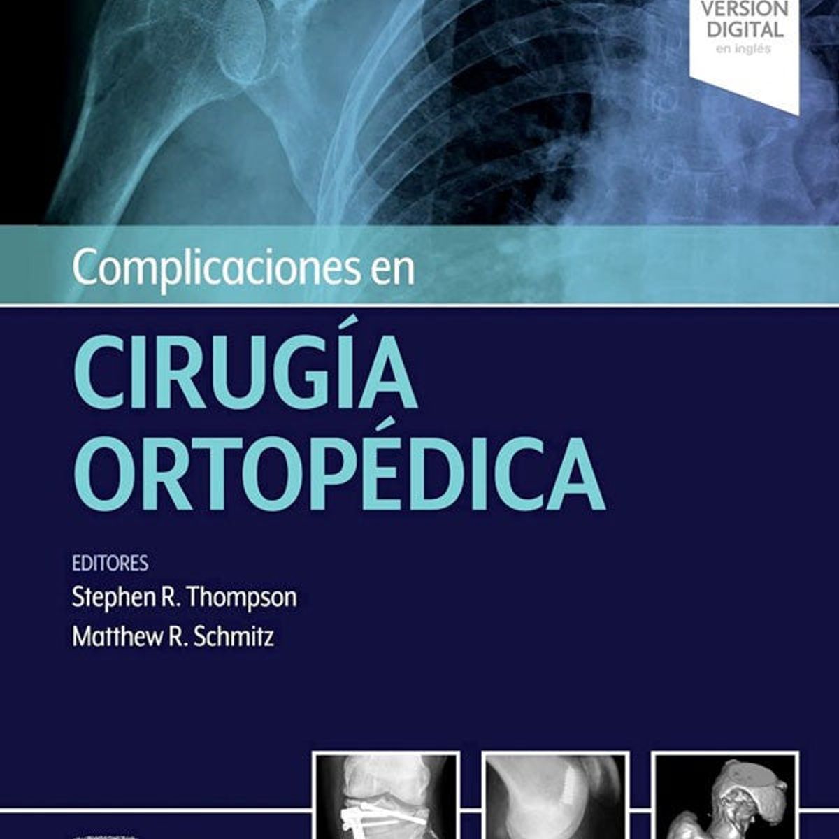 EDITORIAL MEDITERRANEO - Libro Complicaciones En Cirugía Ortopédica