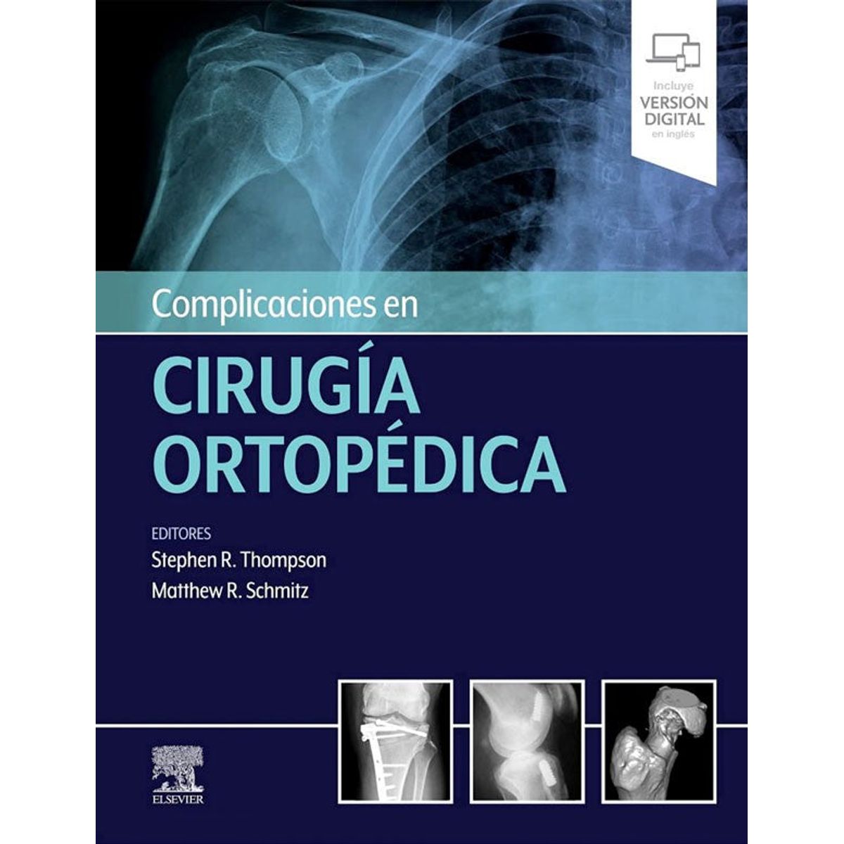 EDITORIAL MEDITERRANEO - Libro Complicaciones En Cirugía Ortopédica