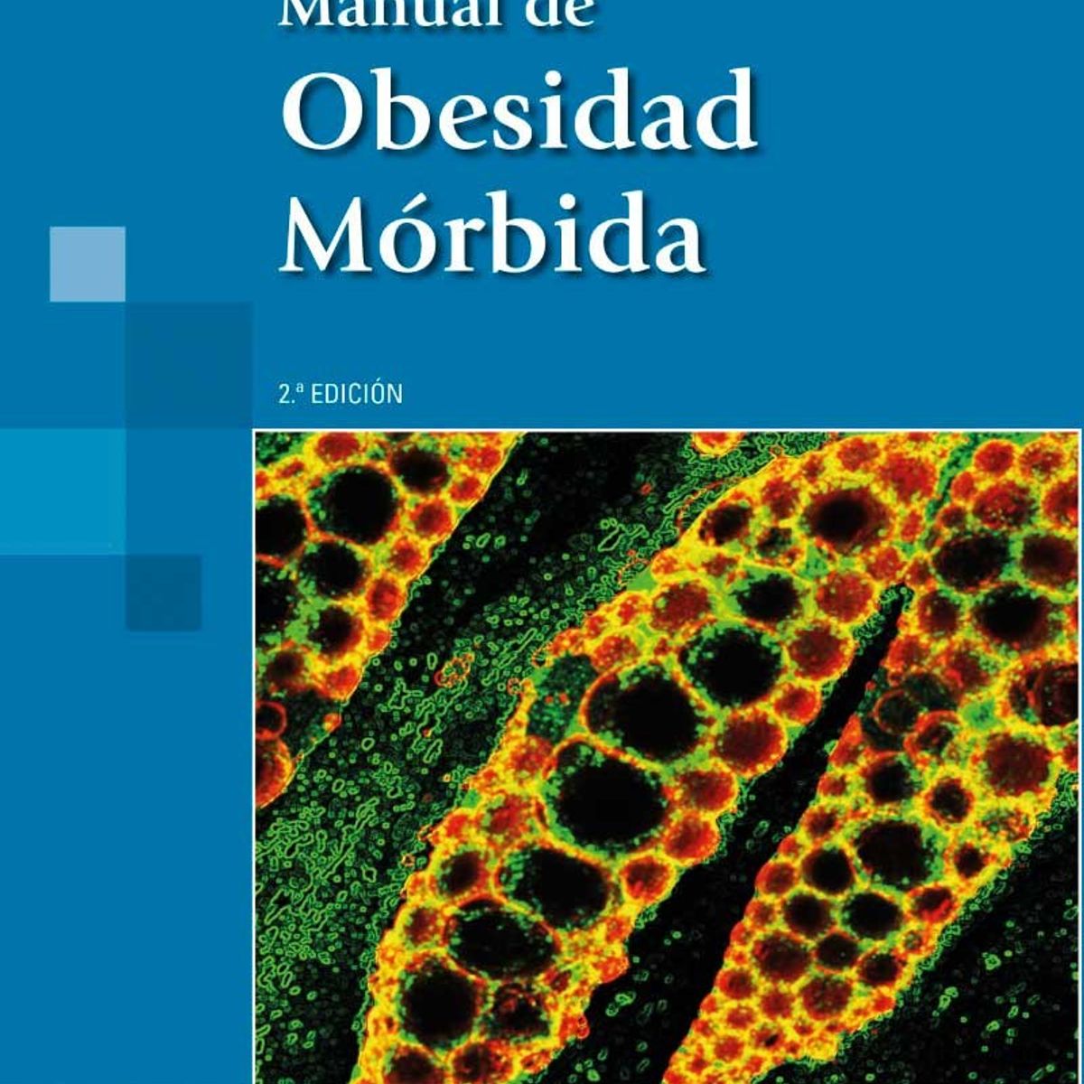EDITORIAL MEDITERRANEO - Libro Manual De Obesidad Mórbida 2Ed