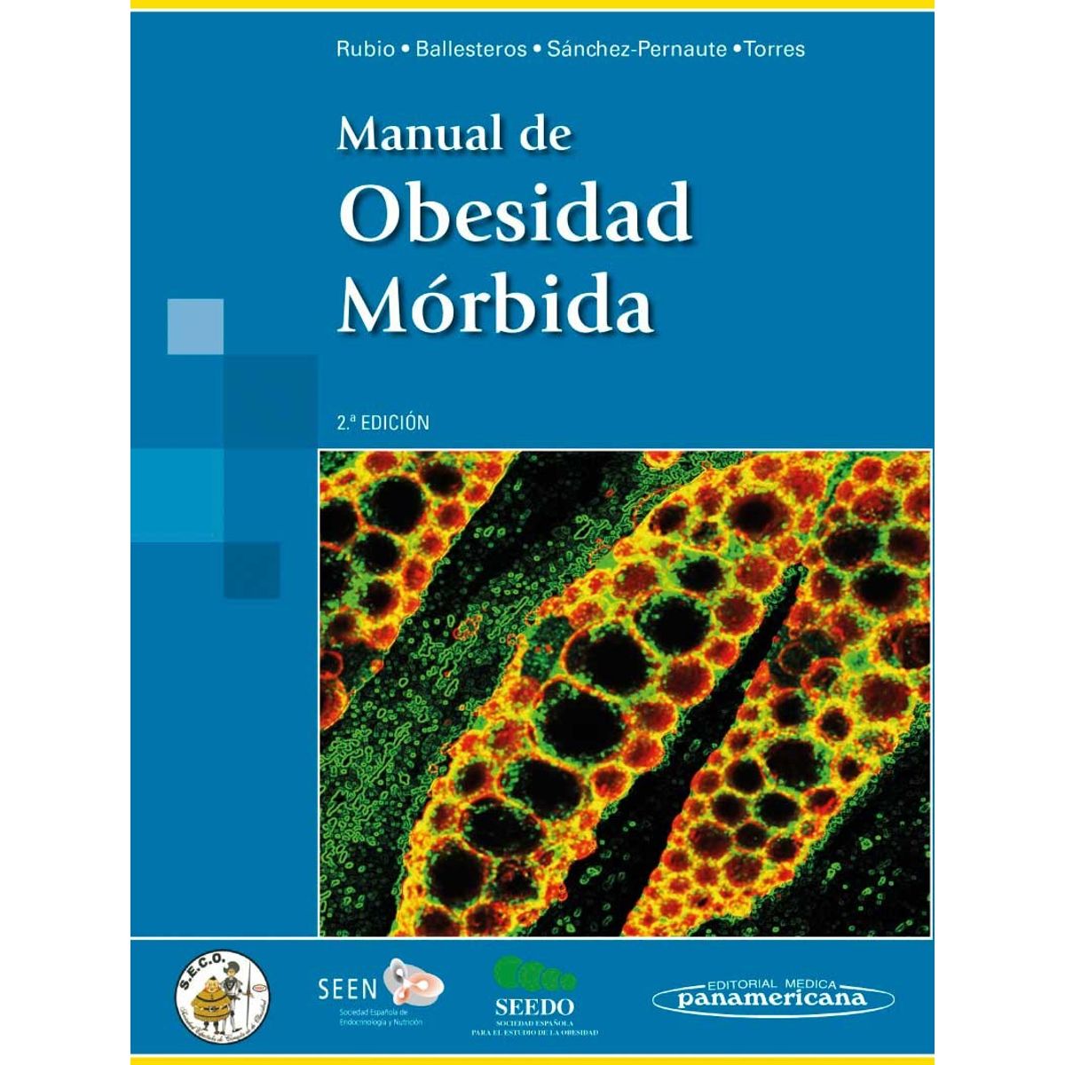 EDITORIAL MEDITERRANEO - Libro Manual De Obesidad Mórbida 2Ed