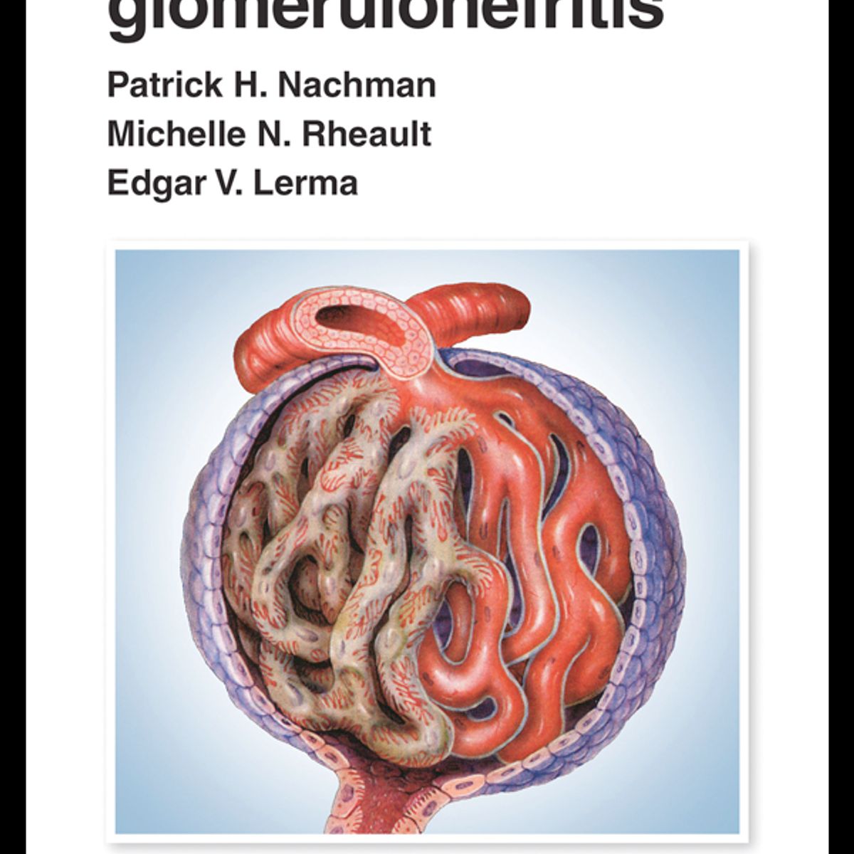 EDITORIAL MEDITERRANEO - Libro Manual De Glomerulonefritis