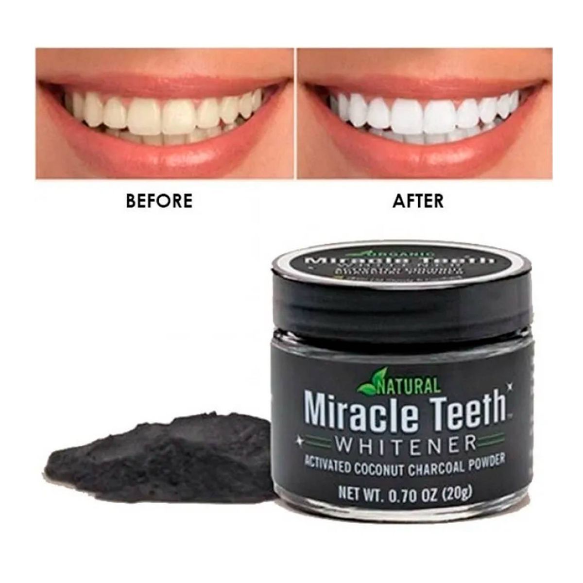 MOVI - BLANQUEADOR DENTAL POLVO DE CARBÓN