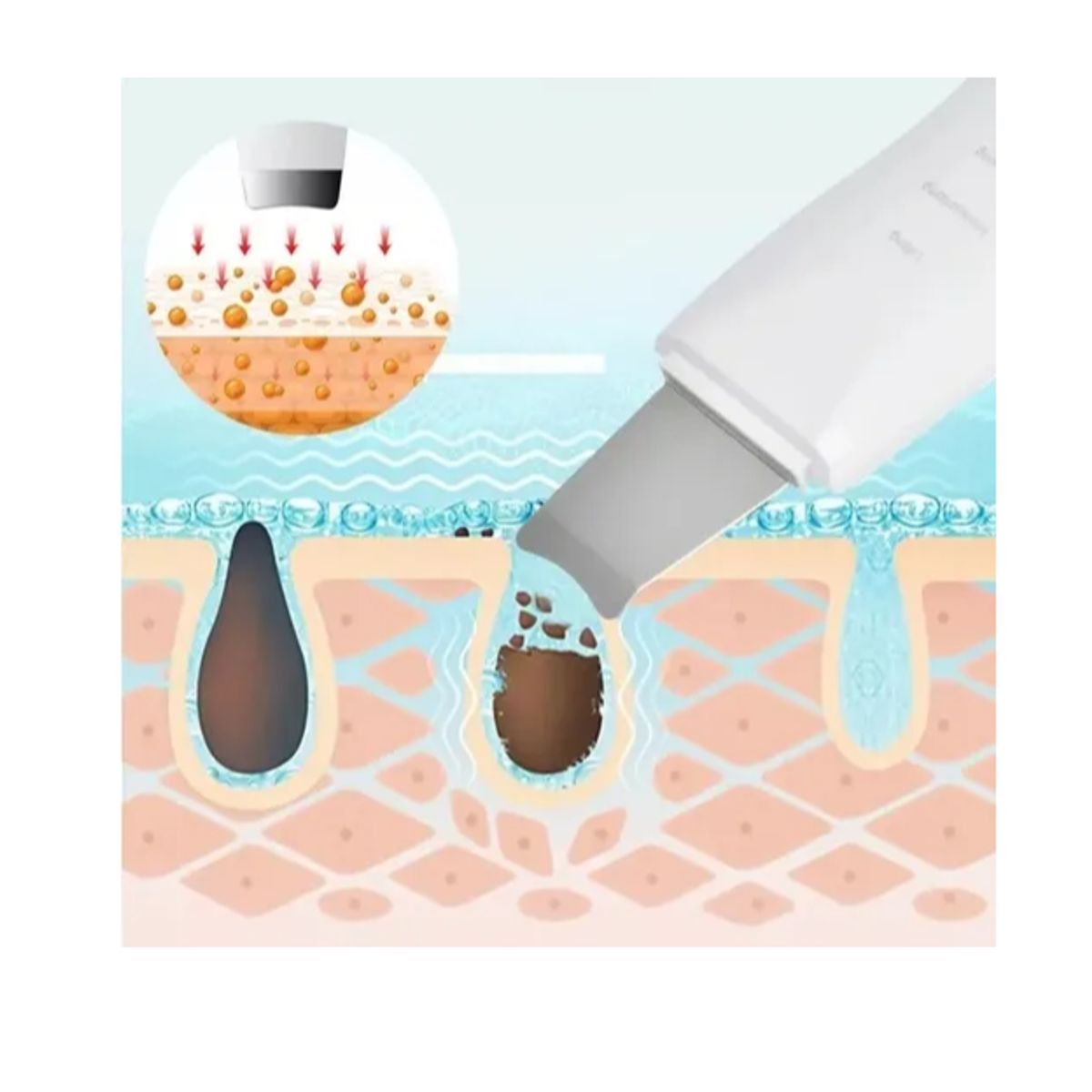 GENERICO - Paleta Limpiador Ultrasónico Facial Digital Peeling Lifting