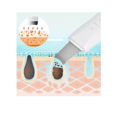 Imagen 2 del producto Paleta Limpiador Ultrasónico Facial Digital Peeling Lifting