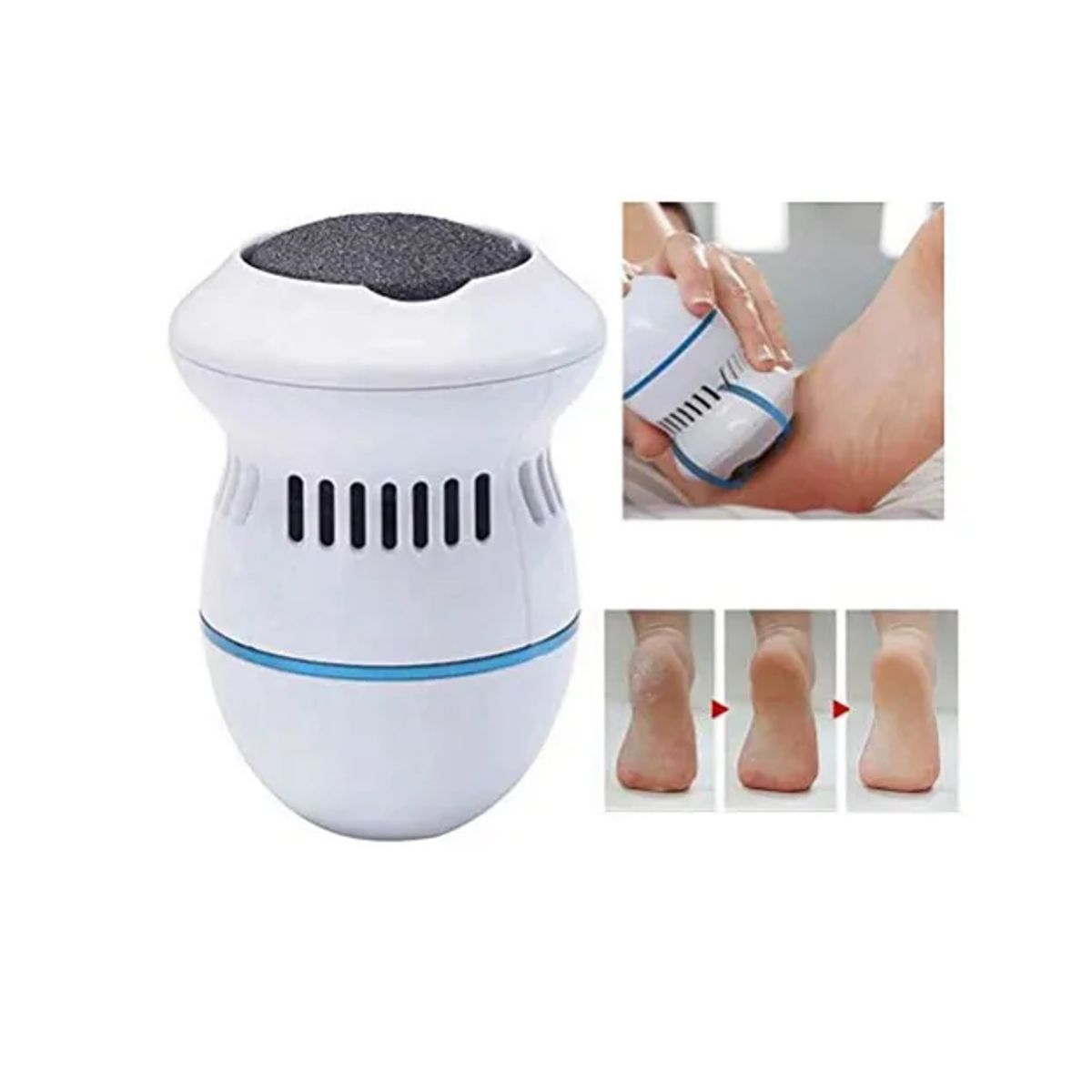 GENERICO - Removedor De Callos Exfoliador Limpieza Pies Suaves Usb Color Blanco