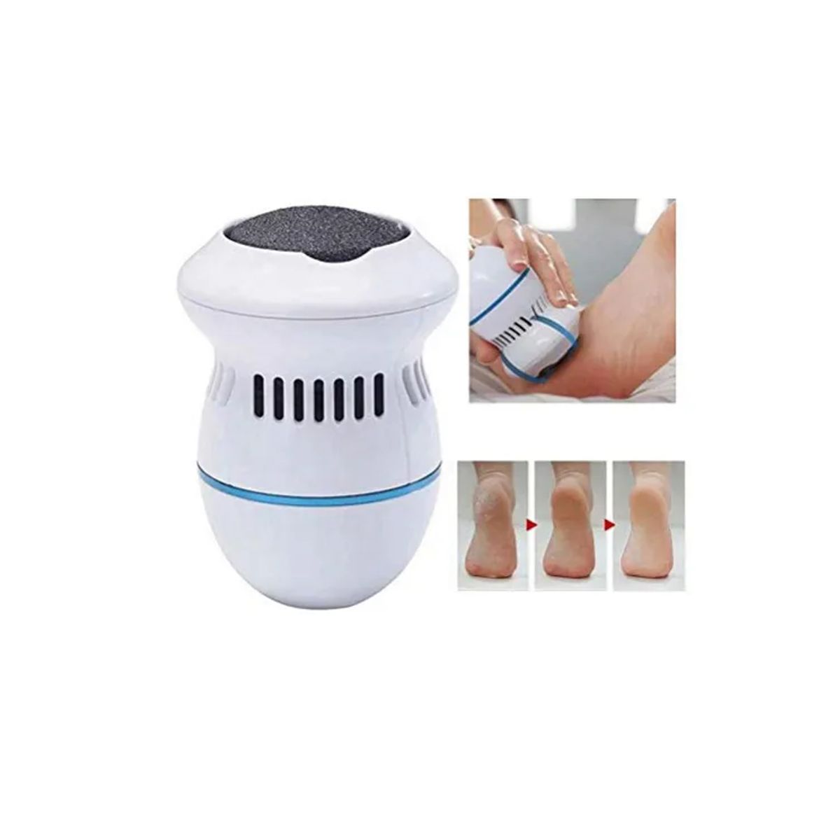 GENERICO - Removedor De Callos Exfoliador Limpieza Pies Suaves Usb Color Blanco