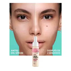 CYZONE - Serum Corrector facial con Niacinamida Skin First 19 ml