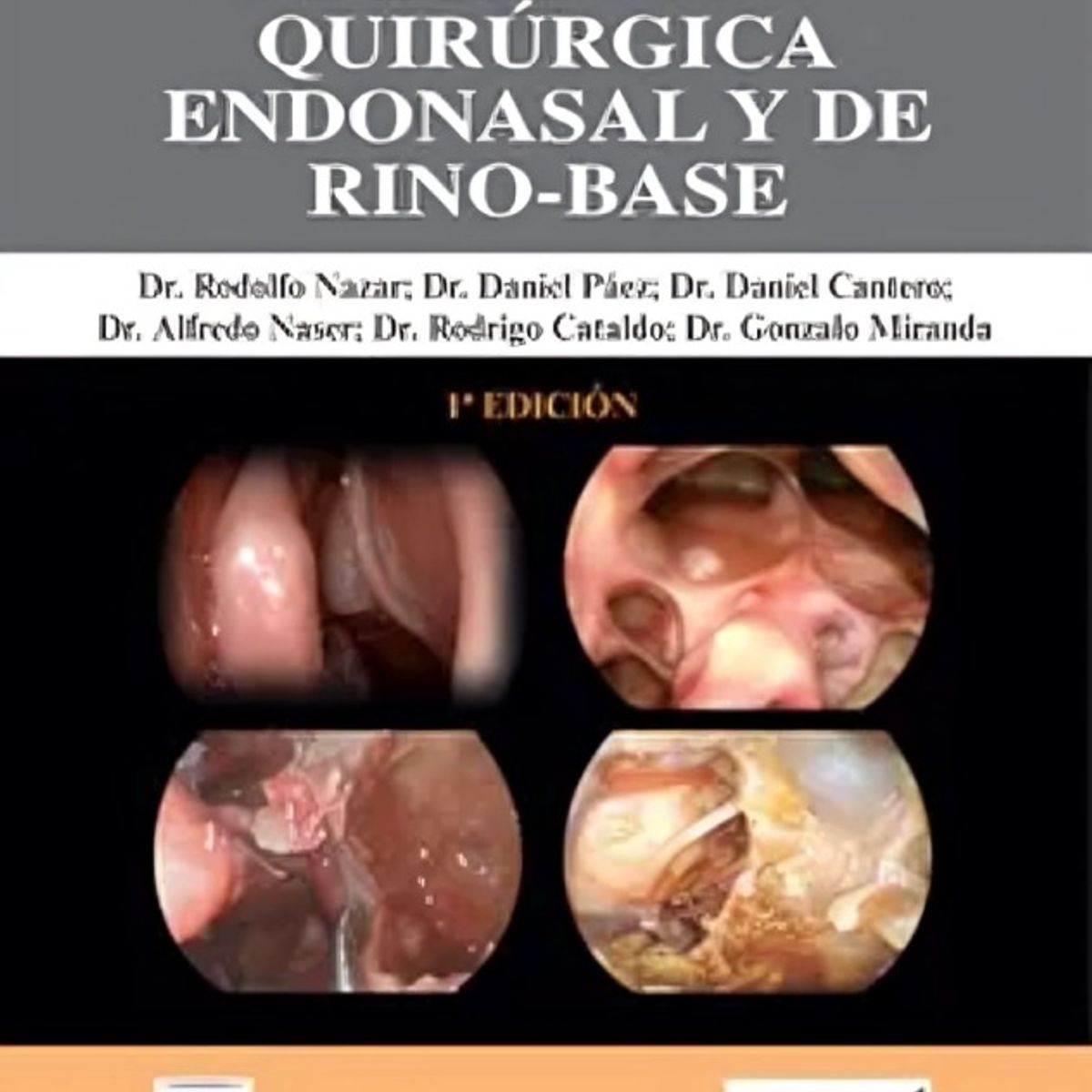 TOP10BOOKS - LIBRO Atlas De Disección Quirúrgica Endonasal Y De Rino-Base