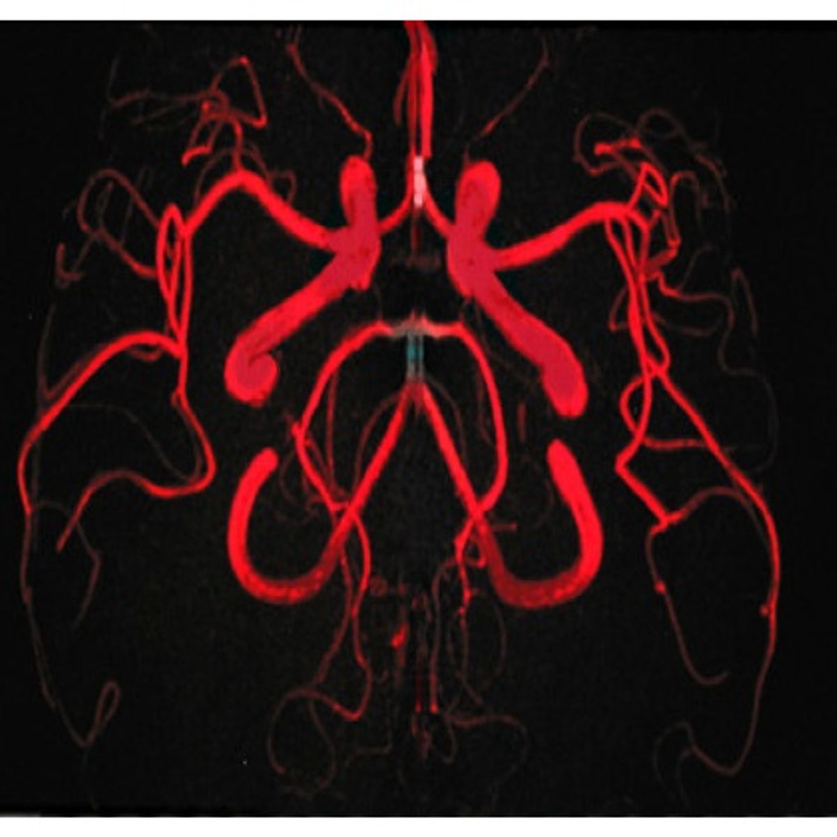 GENERICO - PETER GABRIEL - SCRATCH MY BACK / CD