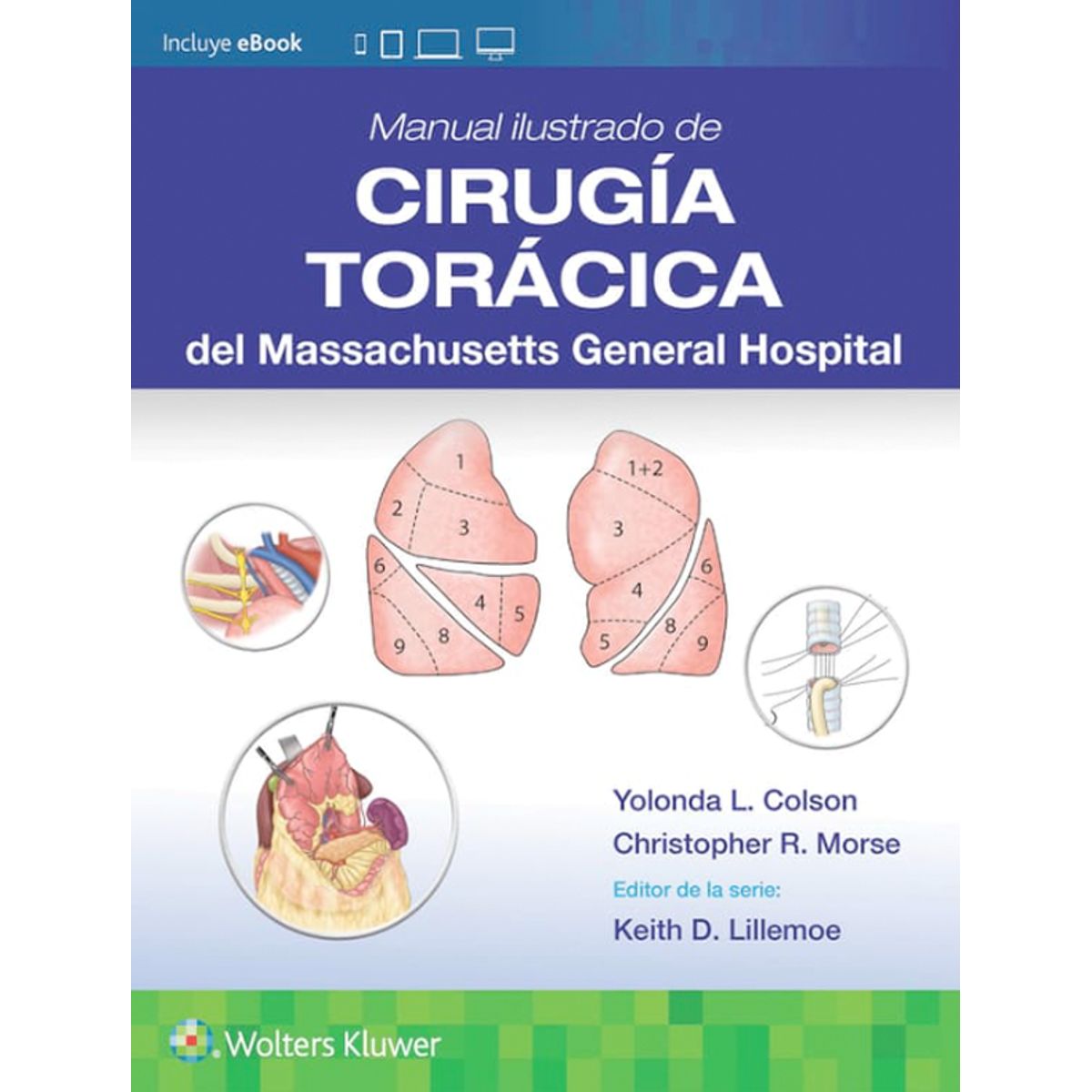 EDITORIAL MEDITERRANEO - Libro Manual ilustrado de Cirugía torácica del Massachusett