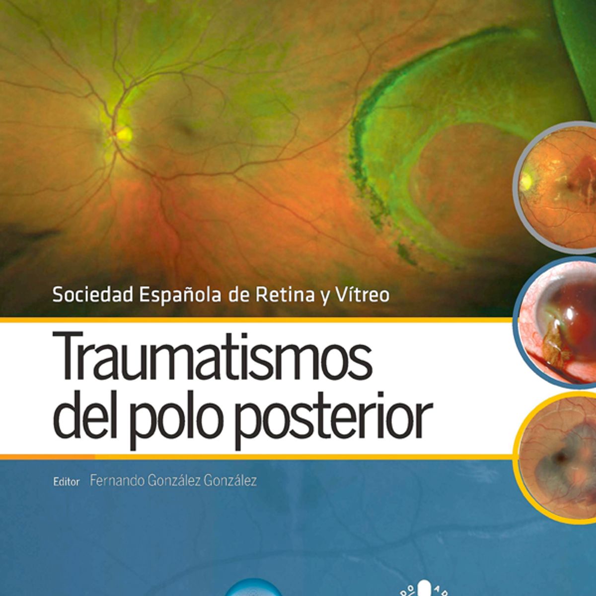 EDITORIAL MEDITERRANEO - Libro Traumatismos del polo posterior