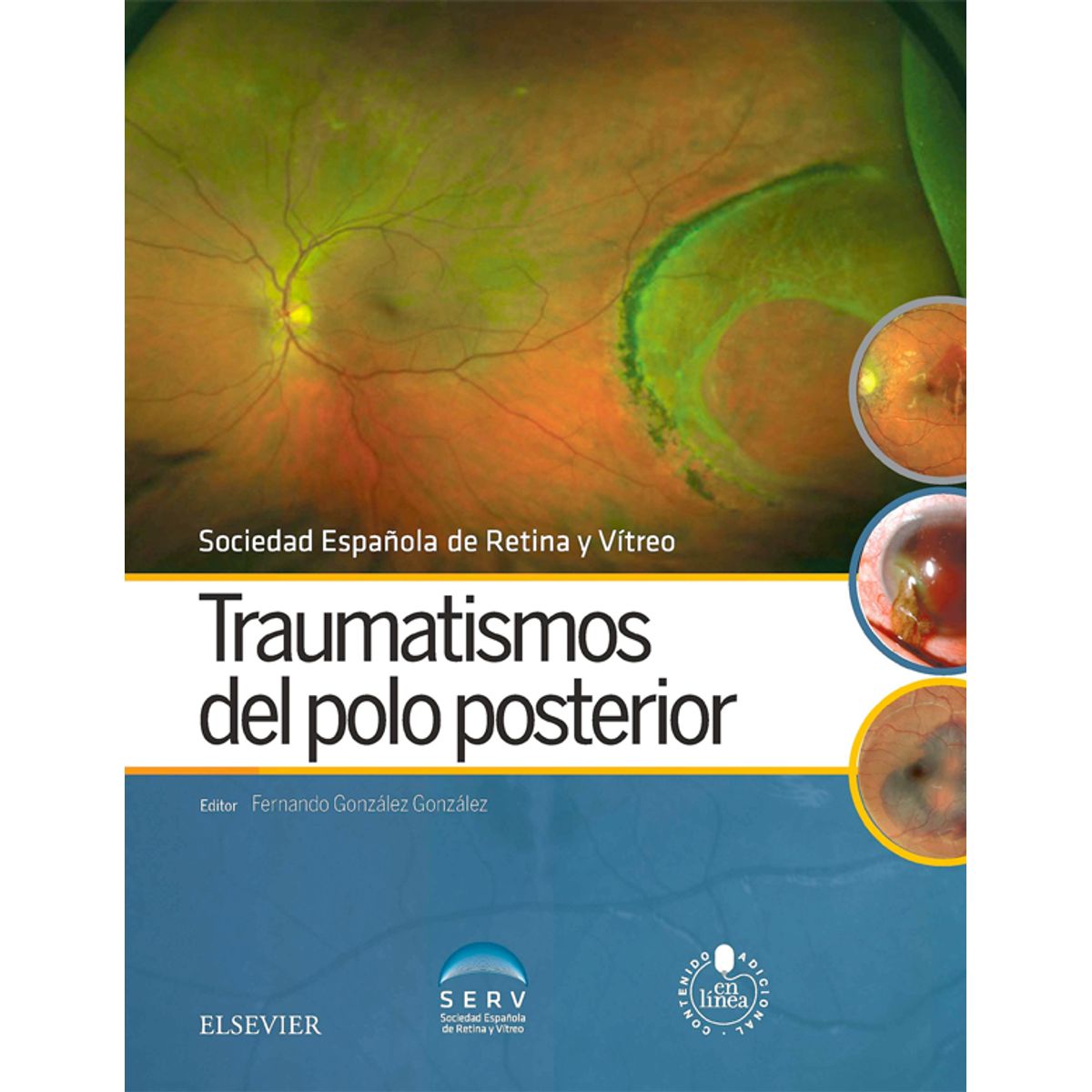 EDITORIAL MEDITERRANEO - Libro Traumatismos del polo posterior