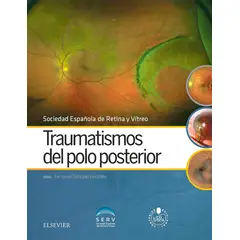 EDITORIAL MEDITERRANEO - Libro Traumatismos del polo posterior
