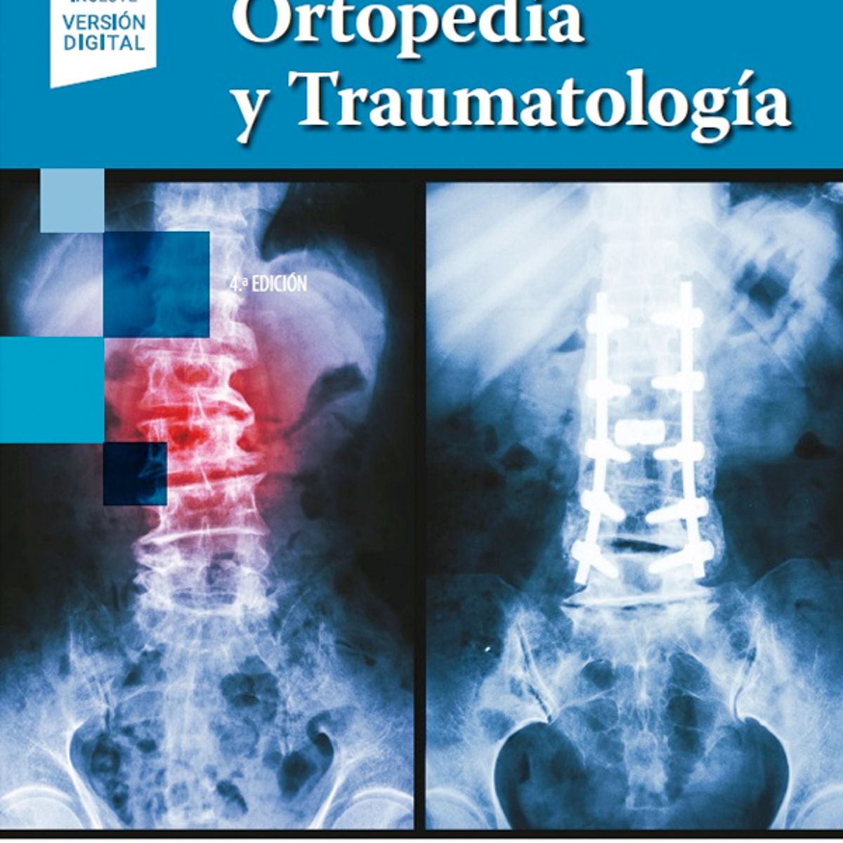EDITORIAL MEDITERRANEO - Libro Ortopedia y Traumatología 4ª Ed.
