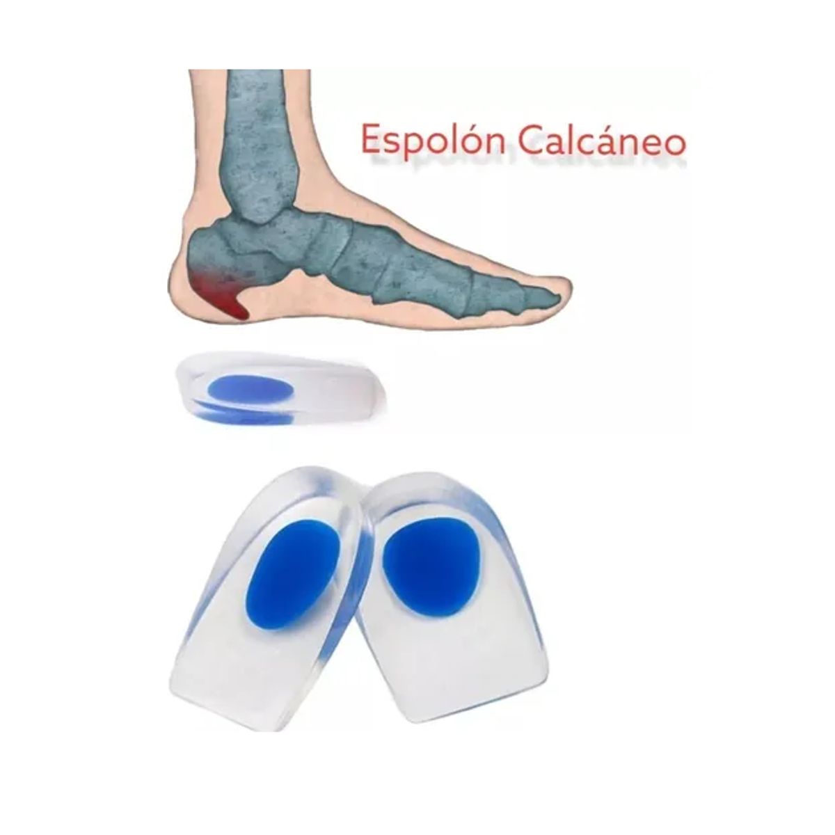 GENERICO - Plantillas Ortopédicas Taloneras Silicona Espolón Fascitis