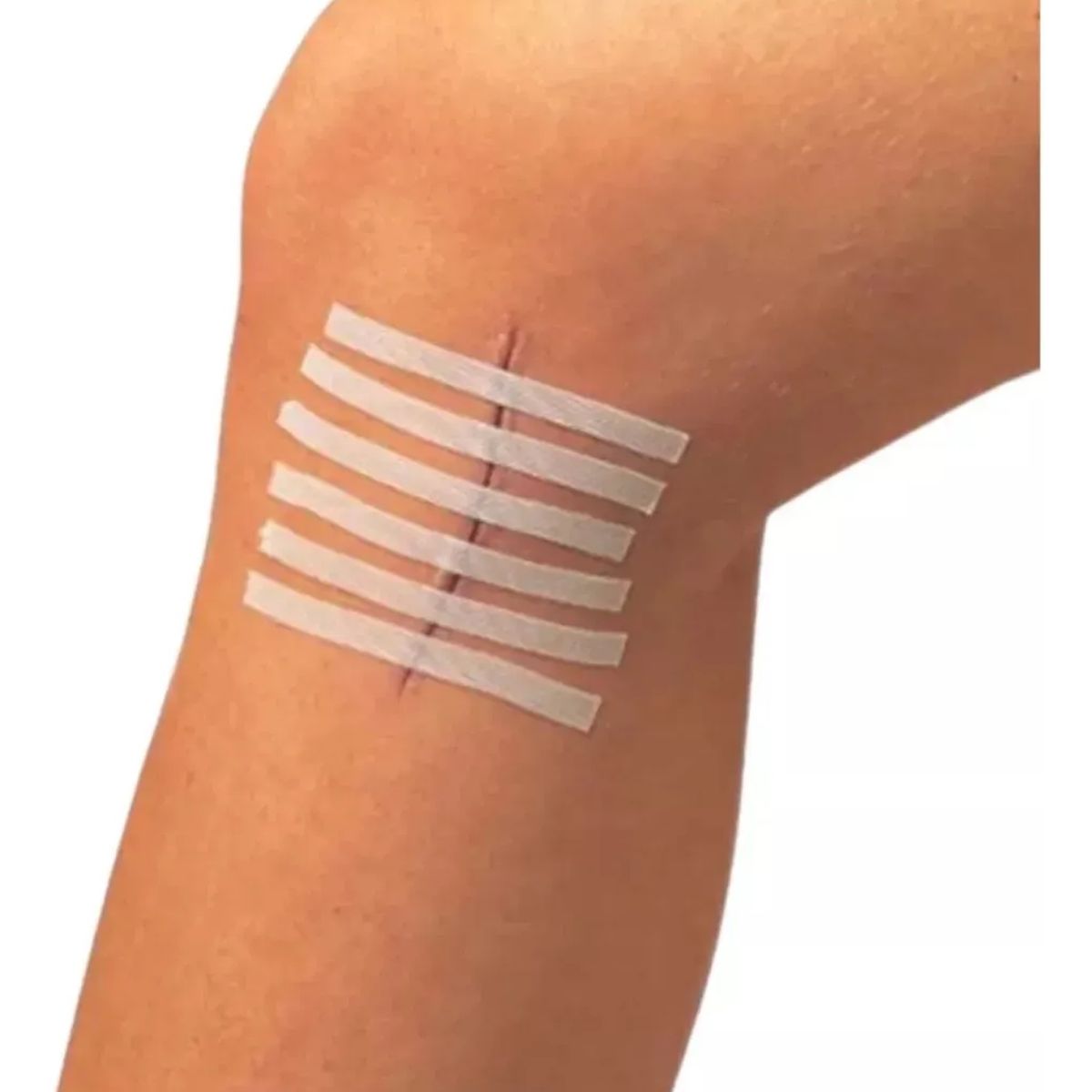 GENERICO - Sutura Adhesiva Heridas 6mm X 100mm 15 Tiras