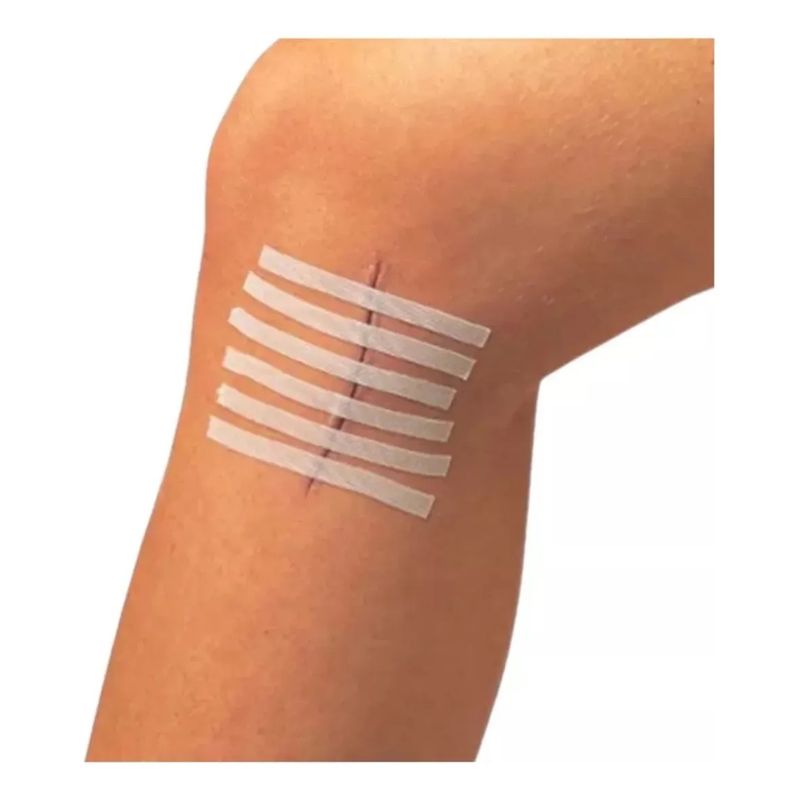 GENERICO - Sutura Adhesiva Heridas 6mm X 100mm 15 Tiras
