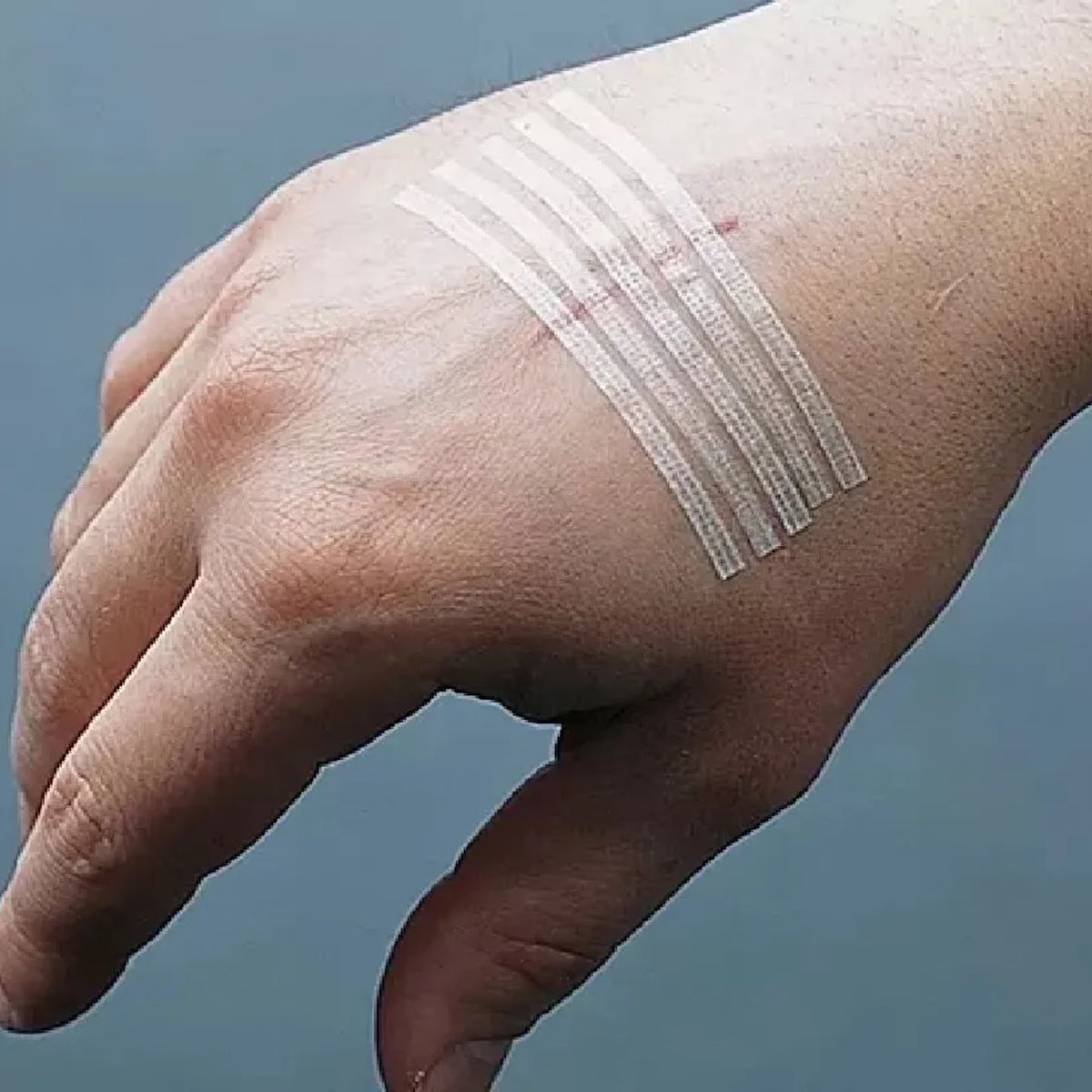 GENERICO - Sutura Adhesiva Heridas 6mm X 100mm 15 Tiras