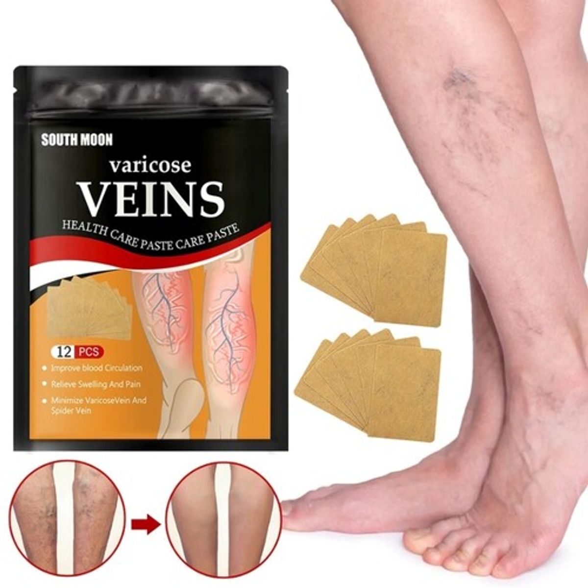 GENERICO - Set 12 Parches Alivio Varices De Las Piernas