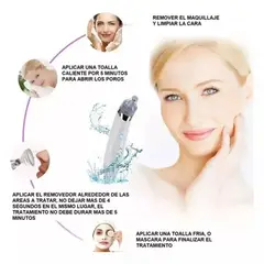 MOVI - Removedor extractor de Puntos Negros e Impurezas