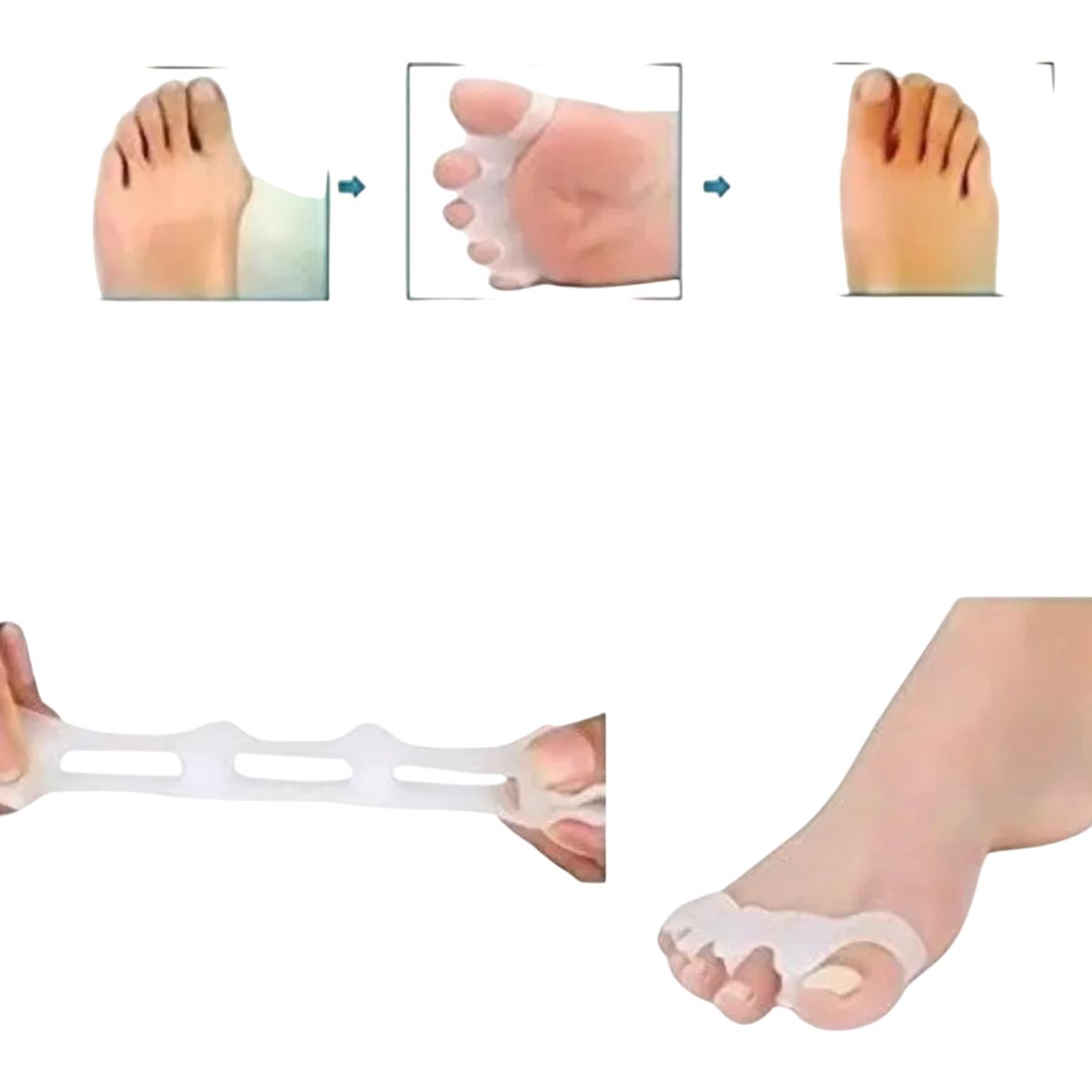 GENERICO - Separador Dedos Pie Corrector Juanete Protector Silicona Par