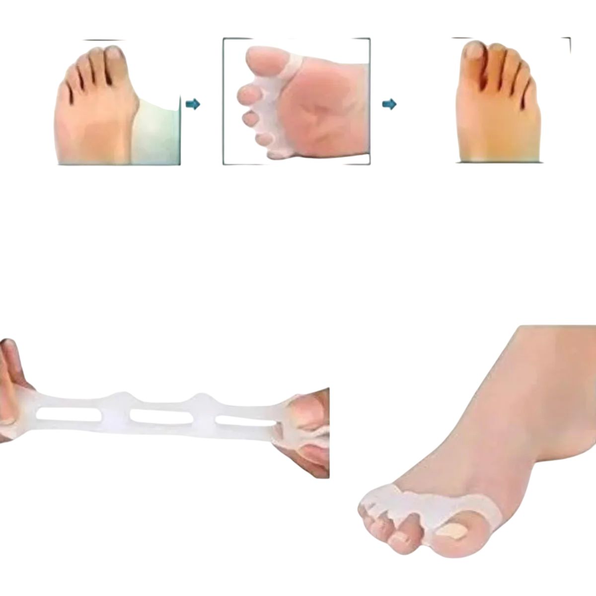 GENERICO - Separador Dedos Pie Corrector Juanete Protector Silicona Par