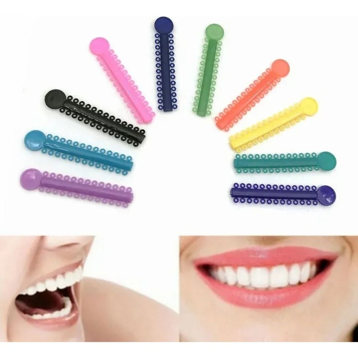 GENERICO - X2 Pack Bandas Ligaduras Elásticos Ortodoncia Color Surtidos