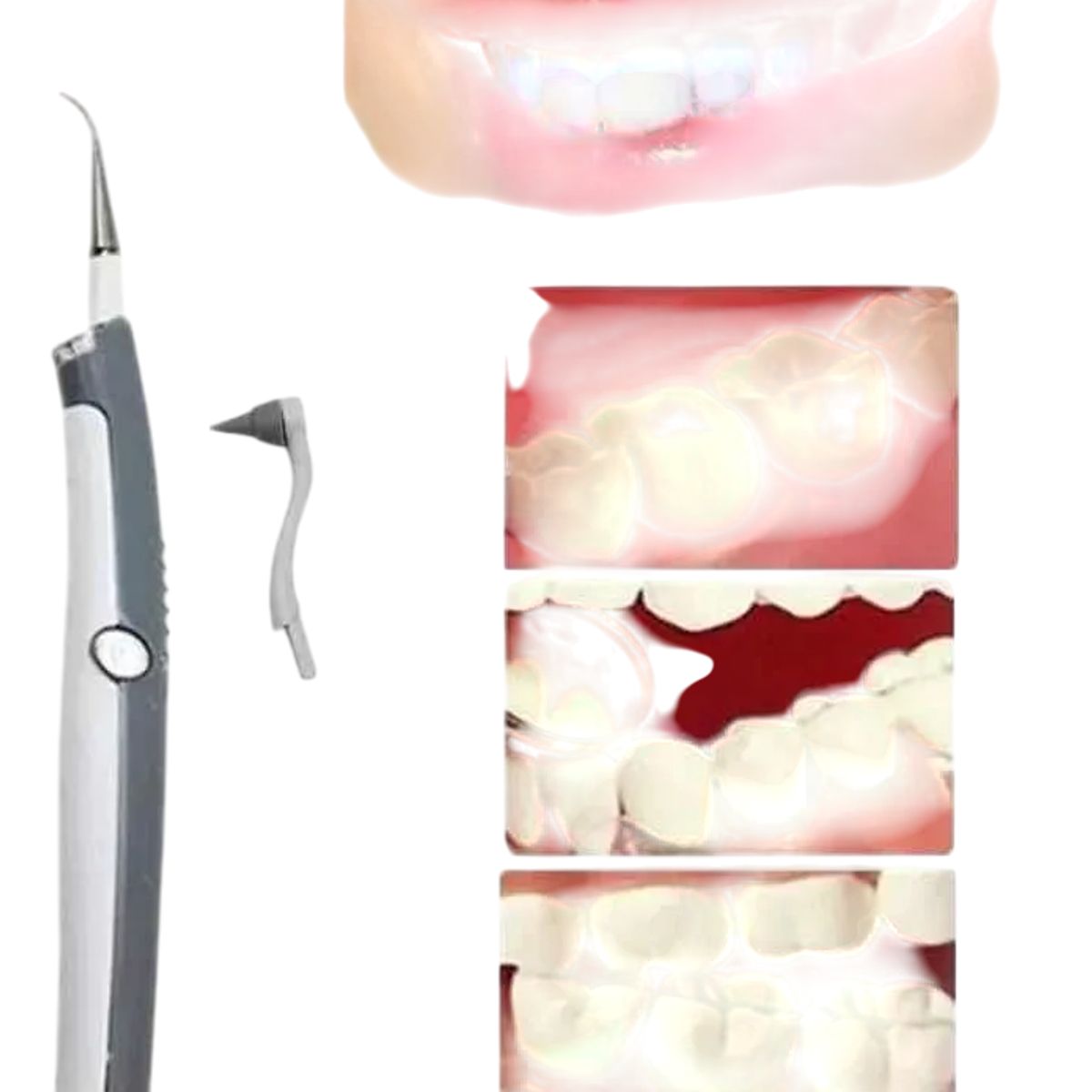 GENERICO - Blanqueador Dental Blancamiento Ultra Sónico Limpieza Dental