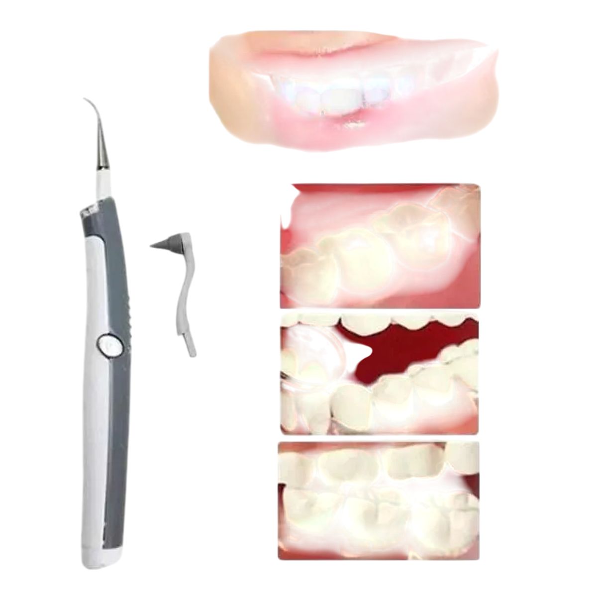 GENERICO - Blanqueador Dental Blancamiento Ultra Sónico Limpieza Dental