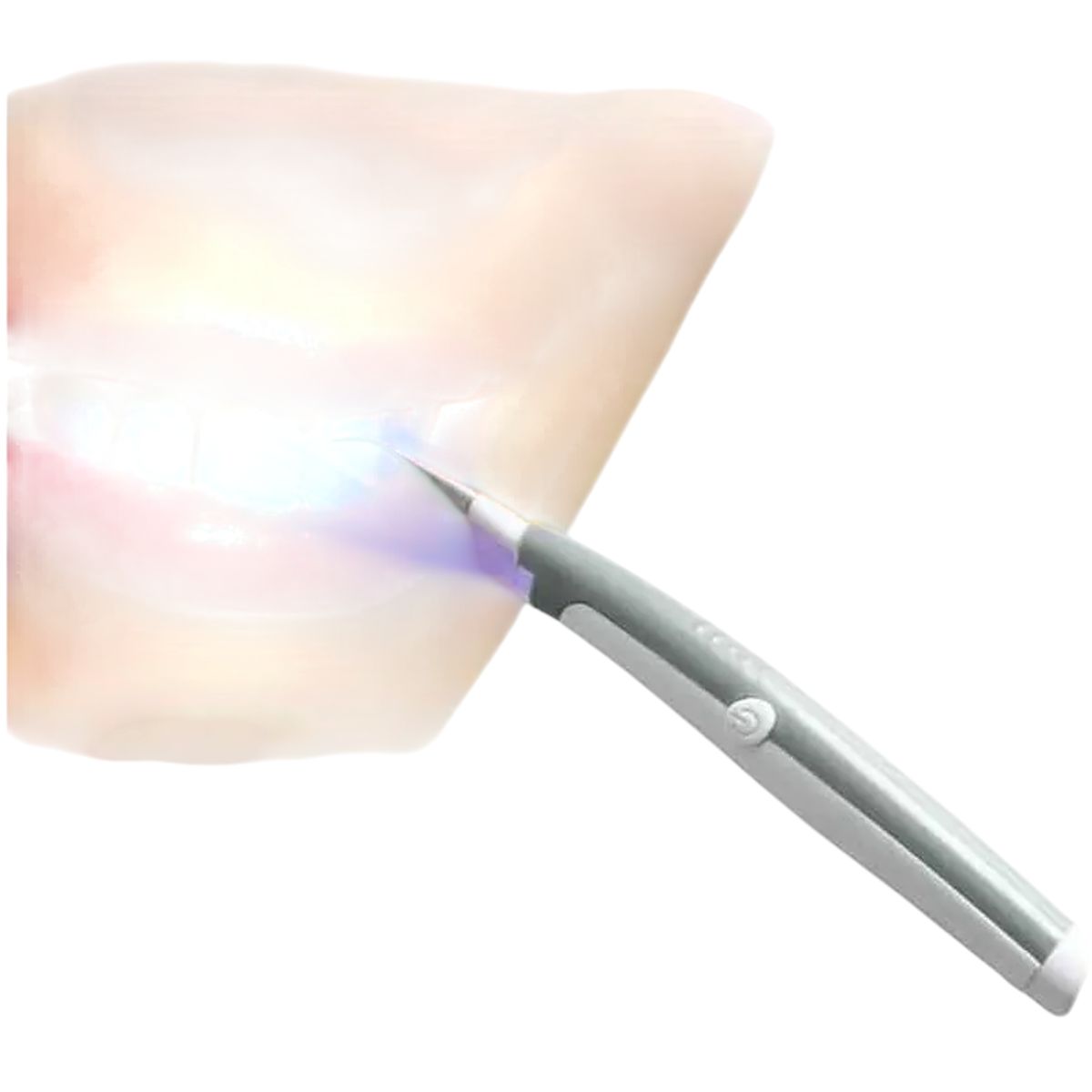 GENERICO - Blanqueador Dental Blancamiento Ultra Sónico Limpieza Dental