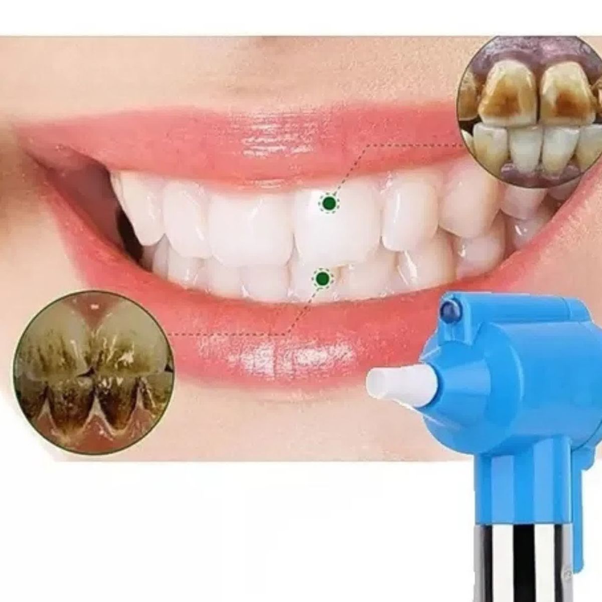 MOVI - Lápiz Blanqueador Dental Luma Smile  Pulido y Sonrisa Radiante