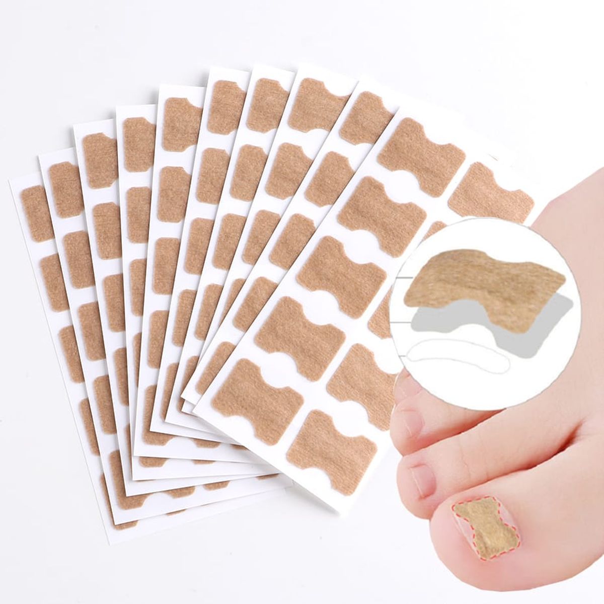 GENERICO - 100 Parches Correctores Uñas Encarnadas Analgésico