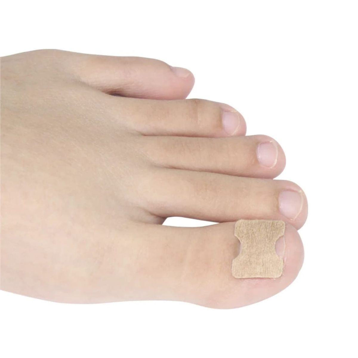 GENERICO - 100 Parches Correctores Uñas Encarnadas Analgésico