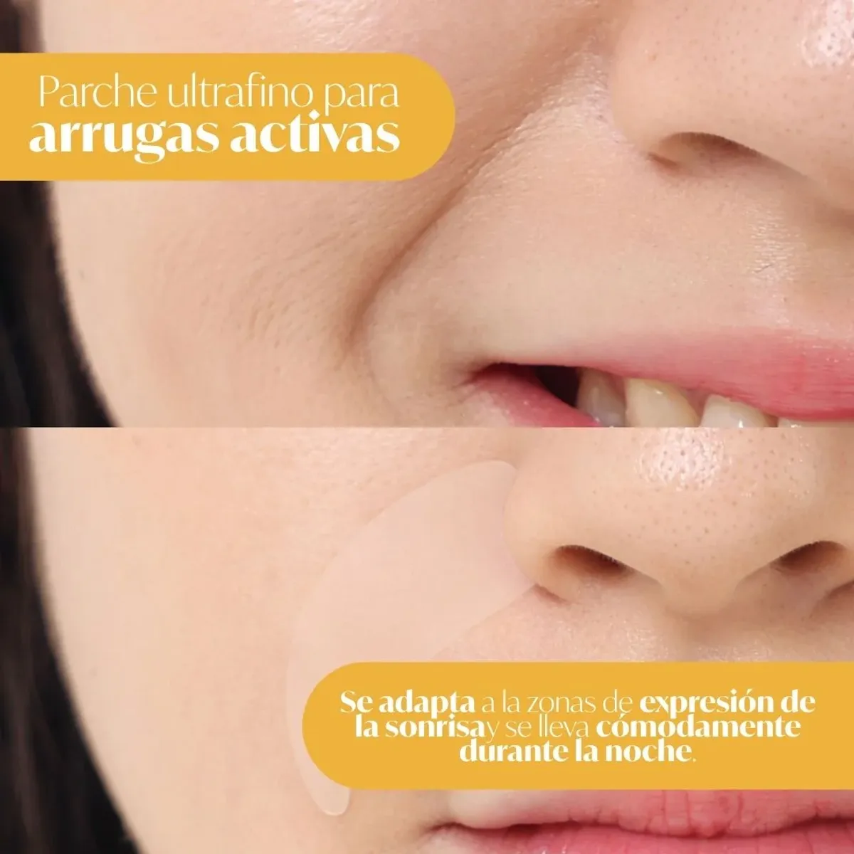 GENERICO - Parche antiarrugas para las líneas de expresión - 1un