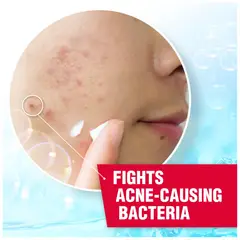 ASEPXIA - Crema para el Tratamiento de Acné 10% Peróxido de Benzoilo