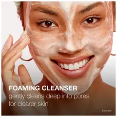 NEUTROGENA - Limpiador Acné 180 mL Sin Aceite con Ácido Salicílico