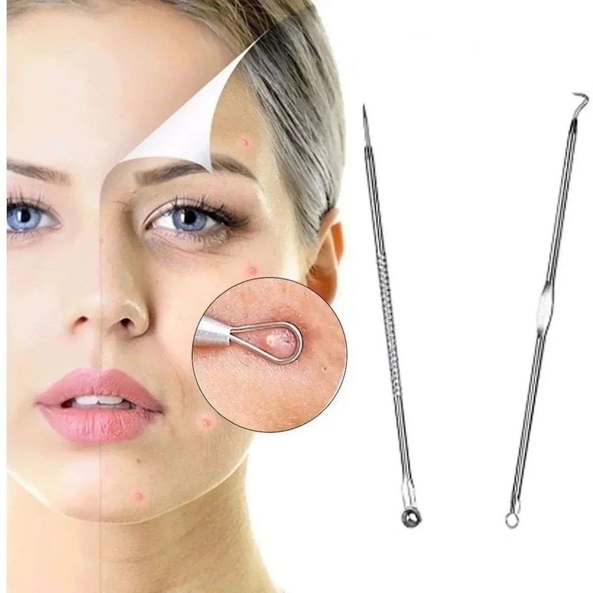 GENERICO - Extractor De Puntos Negros Acné Y Espinillas