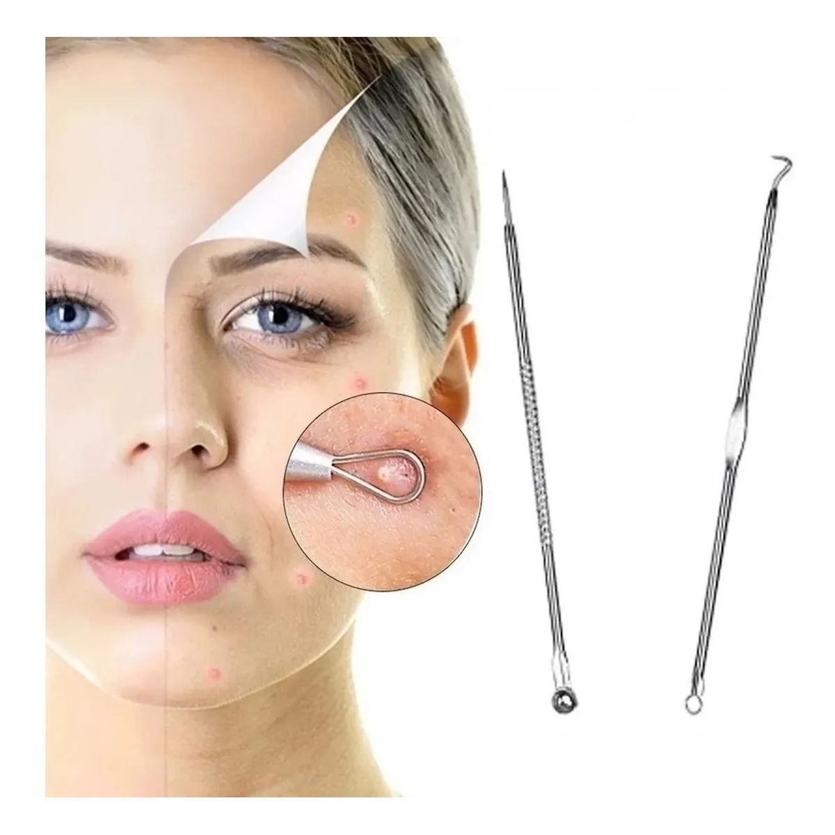 GENERICO - Extractor De Puntos Negros Acné Y Espinillas