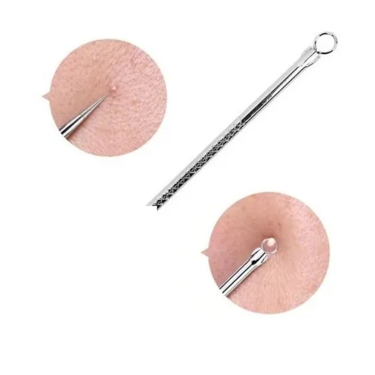 GENERICO - Extractor De Puntos Negros Acné Y Espinillas