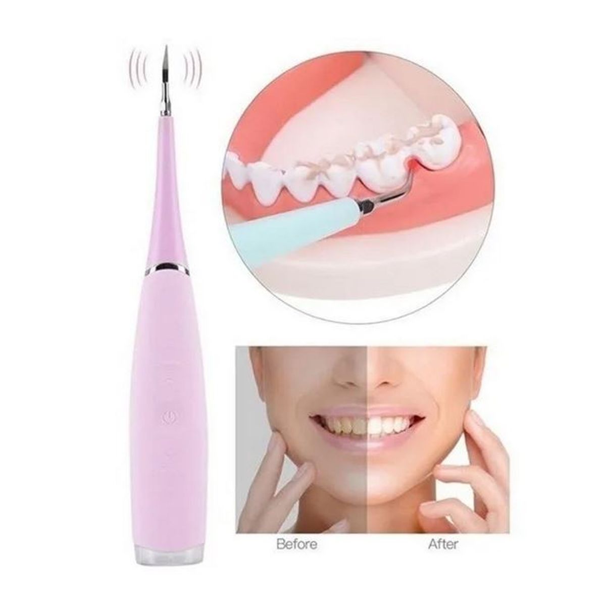 GENERICO - Limpiador De Dientes Eléctrico Removedor Sarro Recargable