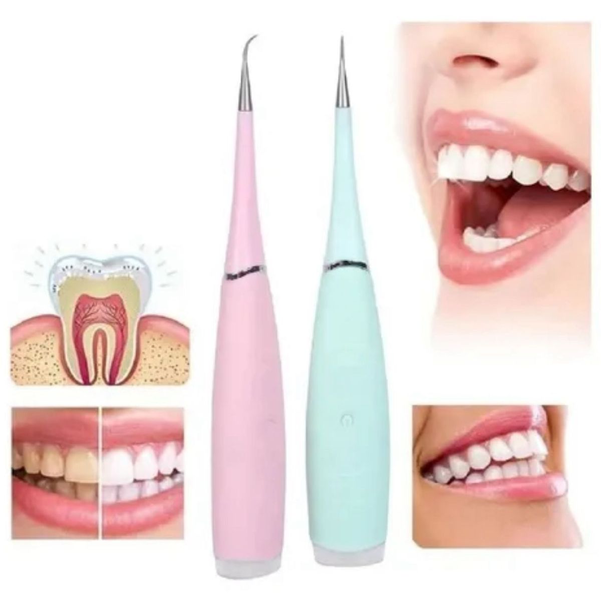 GENERICO - LIMPIADOR ELECTRICO DENTAL