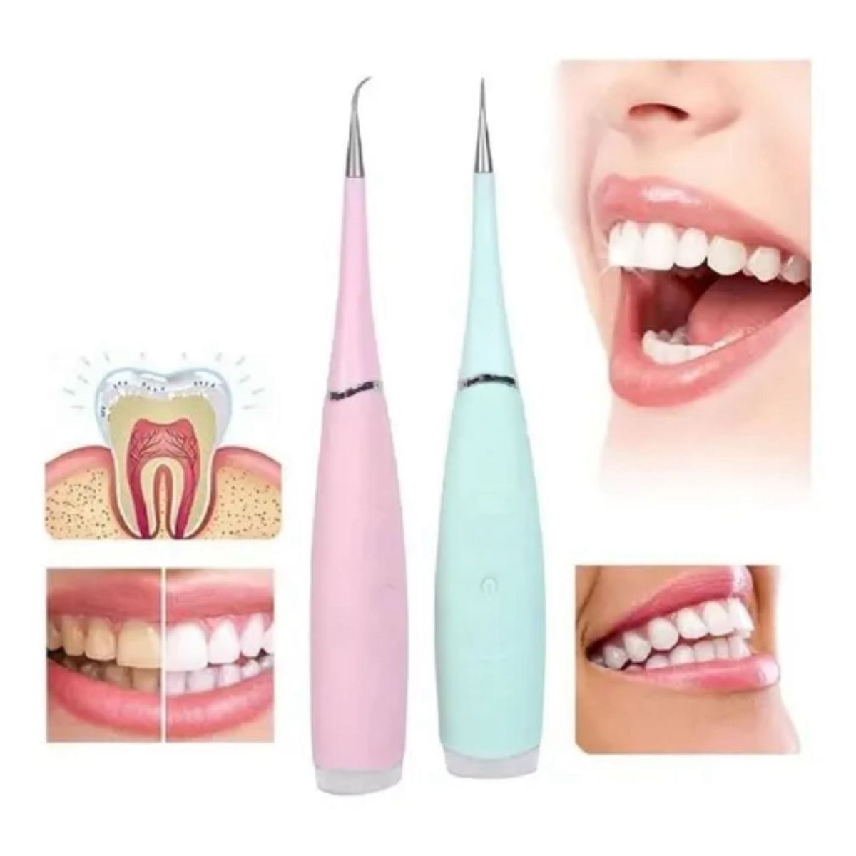 GENERICO - LIMPIADOR ELECTRICO DENTAL