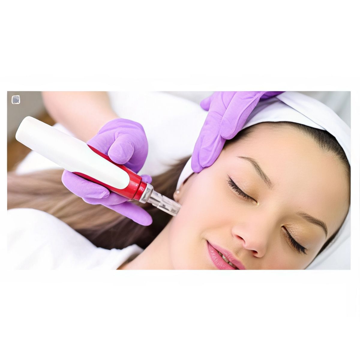 MOVI - Dermapen Facial con Microagujas  Rejuvenecimiento y Cuidado Piel