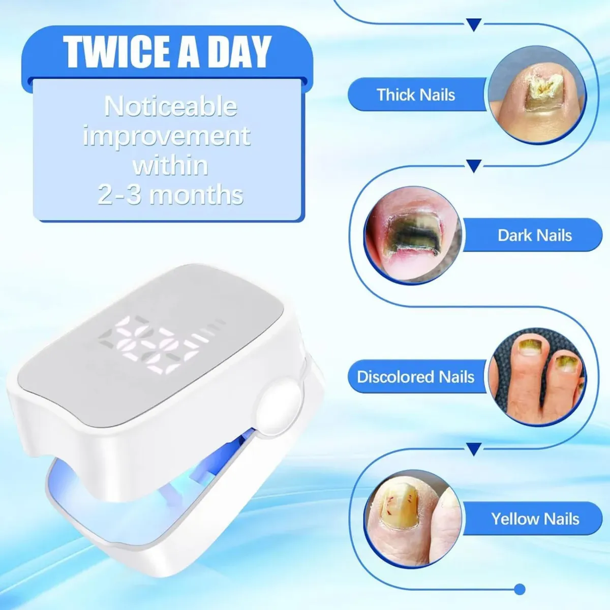 ATURE - A Laser Para Quitar Hongos De Las Uñas Onicomicosis