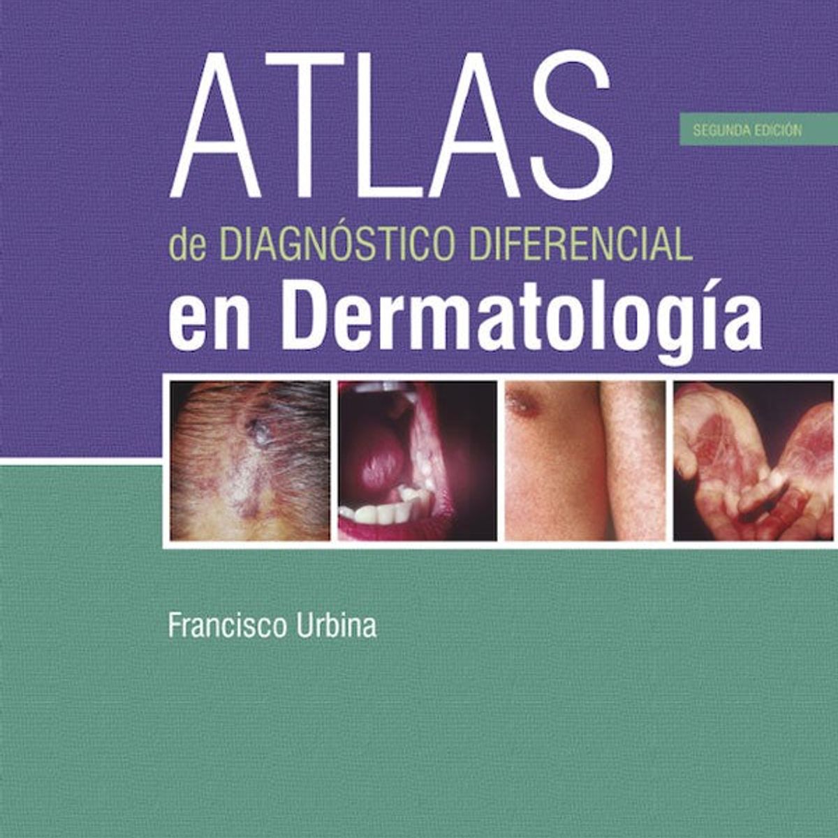 EDITORIAL MEDITERRANEO - Atlas de diagnóstico diferencial en dermatología 2ed.